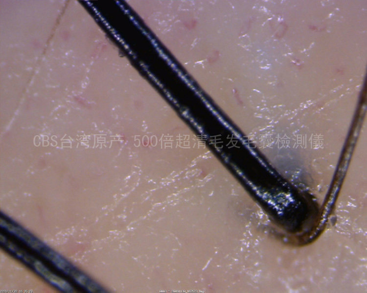 化工 分析仪器 其他分析仪器 ></p></a> 500倍高清毛鳞片检测仪头皮检测仪毛囊