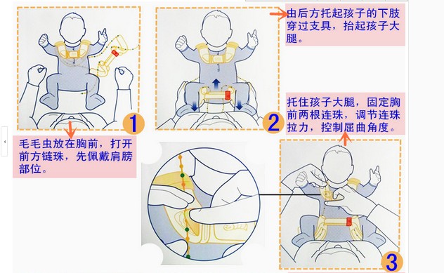 儿童髋关节固定支具髋外展儿童串珠支架新款儿童髋关节矫形器