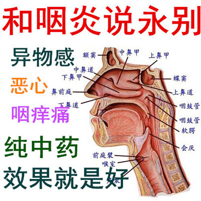 慢性咽炎茶咽喉炎 咽乾咽癢咽痛異物感咳嗽濾泡嘶啞特效中藥噴劑