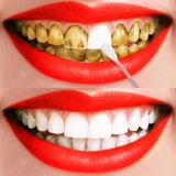 Купить один, получите один свободный [зуб белый не ищет людей] быстро -эффективное отбеливание зубов и артефакт белых зубов, чтобы снять зубы и курить пятна