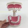 Two times large teeth (disassembly installed with lower teeth)