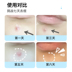 Origins Yue Muzhiyuan Acne Cleansing Gel Tinh chất trị mụn 10ml tinh chất dưỡng trắng da 