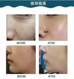 Титановый микрокристаллический водяной световой жидкий набор жидких наборов