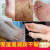 Tây Bạch Kim Dầu Ngựa Nứt Kem Kem Chân Heel Anti-Crystal Burst Foot Cream Giữ Ẩm Chăm Sóc Bàn Chân Nam Giới và phụ nữ tẩy da chai cứng ở gót chân Trị liệu chân