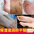 Tây Bạch Kim Dầu Ngựa Nứt Kem Kem Chân Heel Anti-Crystal Burst Foot Cream Giữ Ẩm Chăm Sóc Bàn Chân Nam Giới và phụ nữ