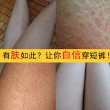 Идите к коже, волосяные волосы. Кератинизированные руки рога вокруг рук об окружающую руку, рук телят и бедер