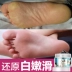 Sáp tử cung ban ngày nuôi dưỡng chân sáp để loại bỏ da bong tróc chân mềm mại chăm sóc chân để đi đến mặt nạ chân sừng cũ kem nứt gót chân Trị liệu chân