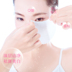 Đích thực làm trắng mảng bám mặt nạ axit tranexamic tàn nhang chloasma điểm mang thai mờ dần đốm mảng bám dán kem mặt nạ giấy trị mụn Mặt nạ