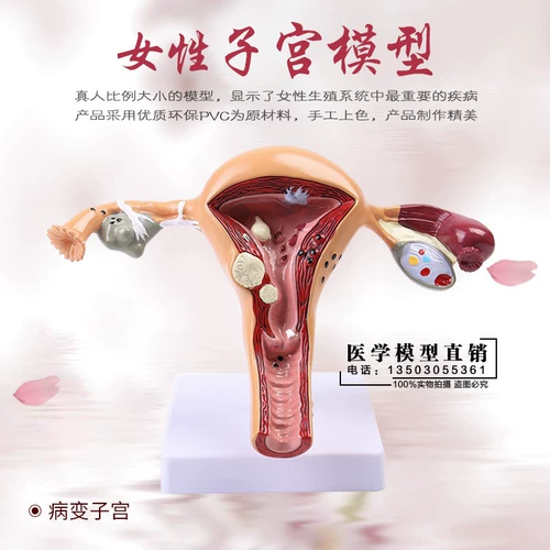 Человеческая модель Женская репродуктивная матка вагинального яичника У преподавания плесени патологические изменения в научных тренировках, преподаваемых