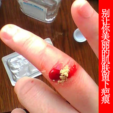 Пластырь 止血粉急救外用烫烧伤摔伤破皮止血金疮药散促进伤口结痂生肌药粉