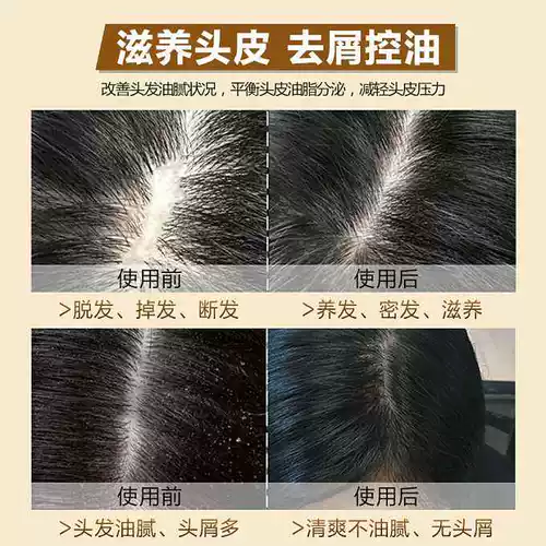 Антибактериальное лечебное сырье для косметических средств с салициловой кислотой, 500г, против зуда