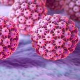 Домашнее место США Somxl Private Warts Обычные бородавки