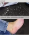 Pháp Tianmei Ruoxi Artemia Hyaluronic Acid đờm Đặt đến chân da chết cũ và bộ chăm sóc bàn chân mặt nạ lột da chân Trị liệu chân