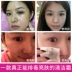 Qiao Yanni tẩy tế bào chết Facial Deep Cleansing Cream Toxin Facial Cleansing lỗ chân lông Detox Massage Cream chính hãng Kem massage mặt