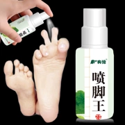 Xịt chân vua xịt chân kháng khuẩn 60ml dung dịch chăm sóc chân xịt chân Wang - Phụ kiện chăm sóc mắt