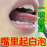Рот на рту, рот языка, боль во внутренней стенке рта, белая точка болит, питательная слизистая оболочка обезболивающих