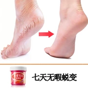 Gót chân kem chăm sóc bàn chân bước chân để da chết kem chân giữ ẩm kem chống khô để sửa chữa bàn chân